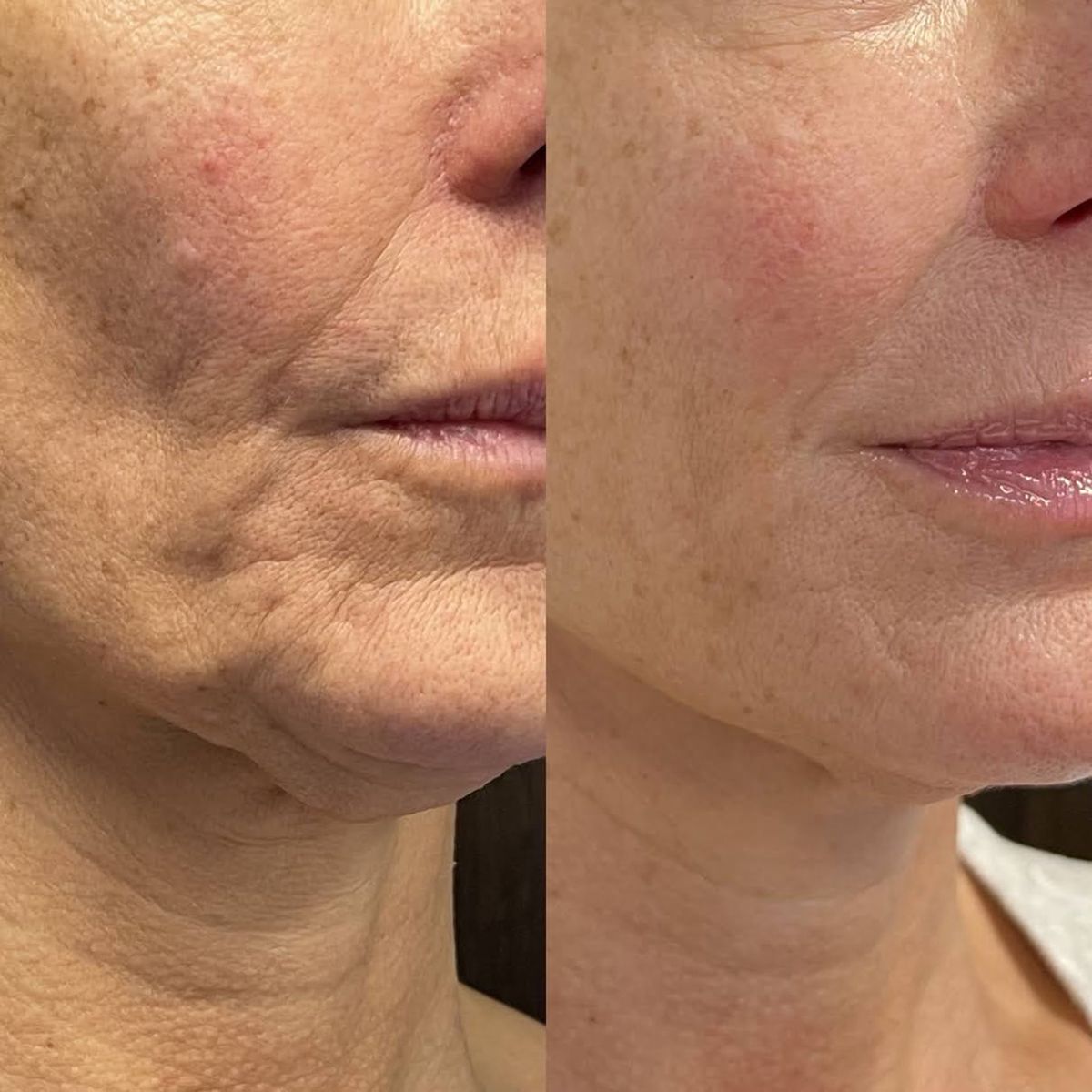 Nectaré Anti-Aging Serum-Stift