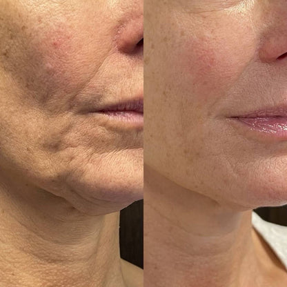 Nectaré Anti-Aging Serum-Stift