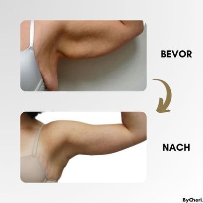 LymphWave™ Paket Hartnäckiges Fett mit lymphatischer Stimulation