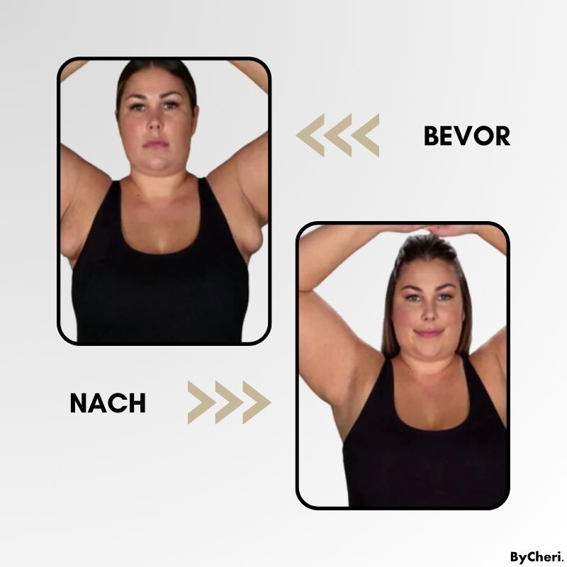 LymphWave™ Paket Hartnäckiges Fett mit lymphatischer Stimulation