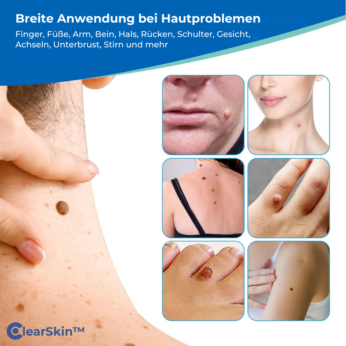 TagRelease™ - Schmerzfreie Hautanhängsel-Entfernung zu Hause