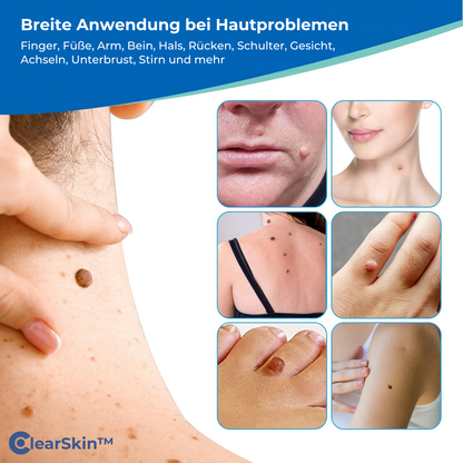 TagRelease™ - Schmerzfreie Hautanhängsel-Entfernung zu Hause