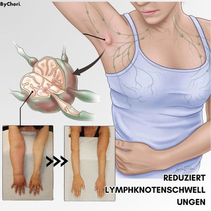 LymphWave™ Paket Hartnäckiges Fett mit lymphatischer Stimulation
