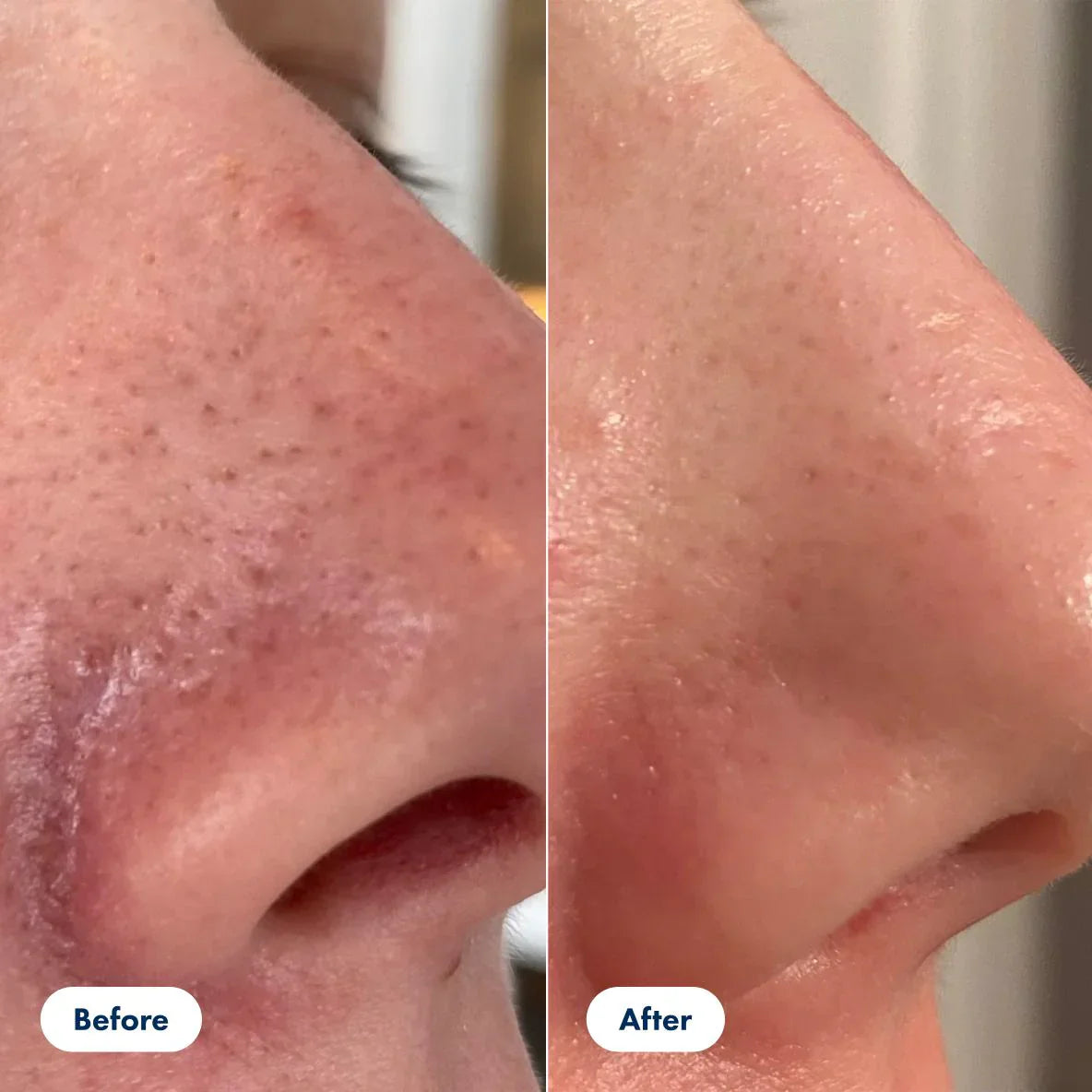 Glyssa™ – Koreanisches Poreless Glass Skin Serum