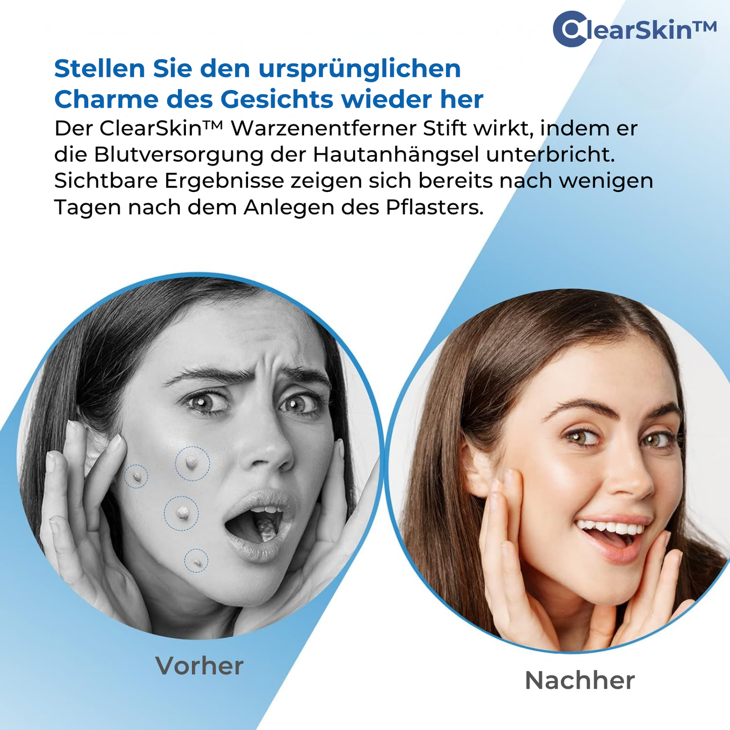 TagRelease™ - Schmerzfreie Hautanhängsel-Entfernung zu Hause