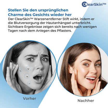 TagRelease™ - Schmerzfreie Hautanhängsel-Entfernung zu Hause