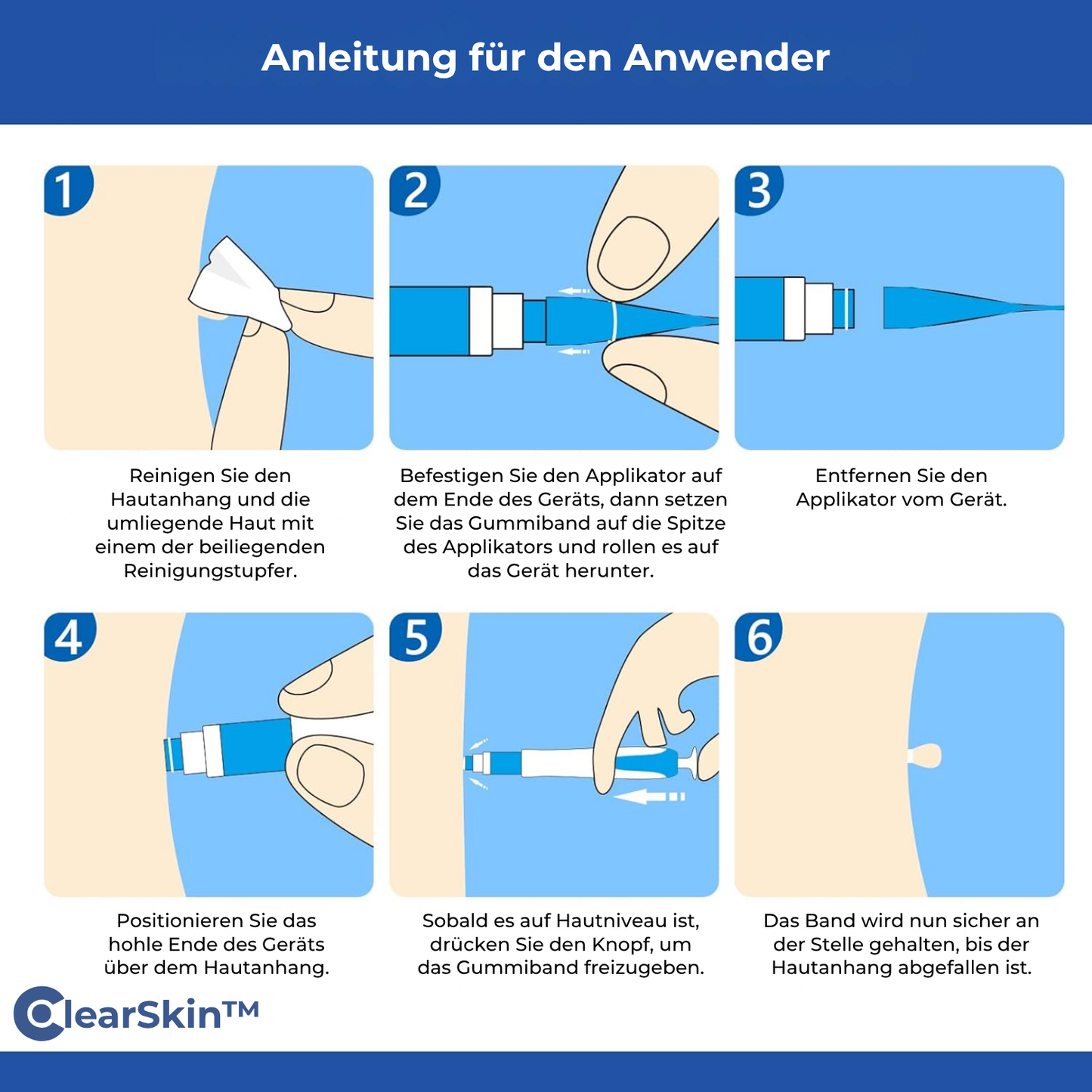 TagRelease™ - Schmerzfreie Hautanhängsel-Entfernung zu Hause