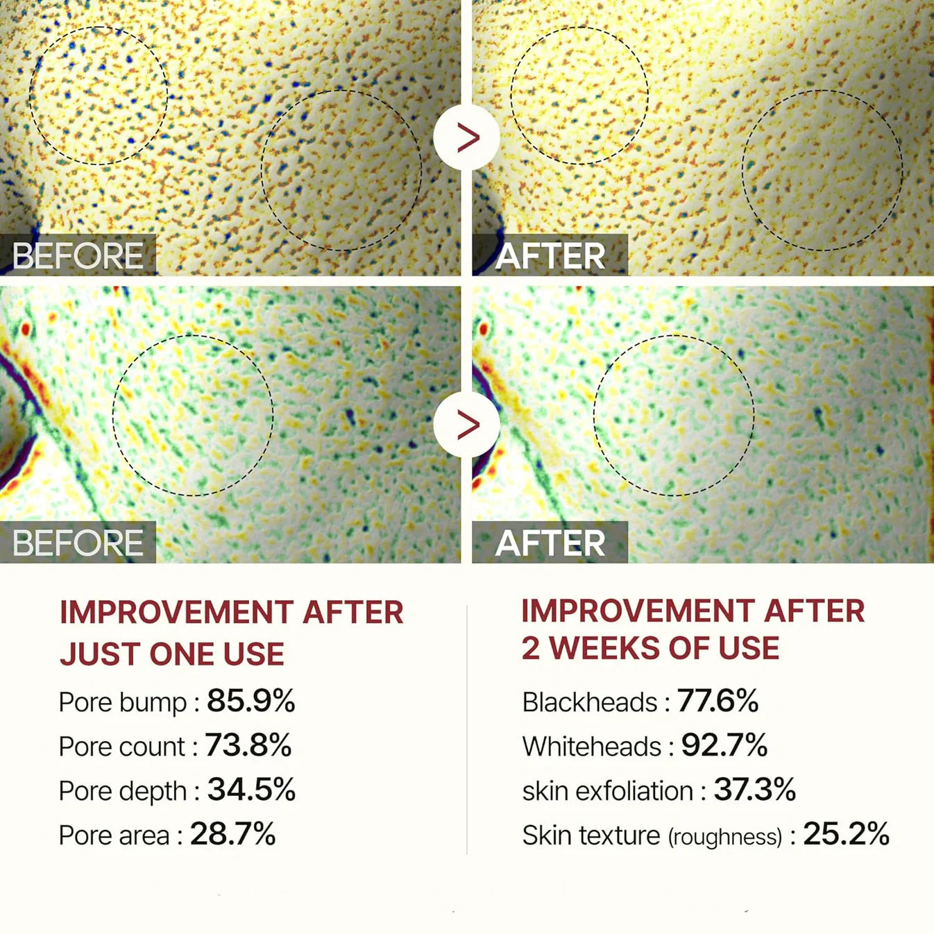 Glyssa™ – Koreanisches Poreless Glass Skin Serum