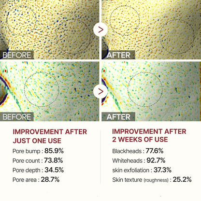 Glyssa™ – Koreanisches Poreless Glass Skin Serum