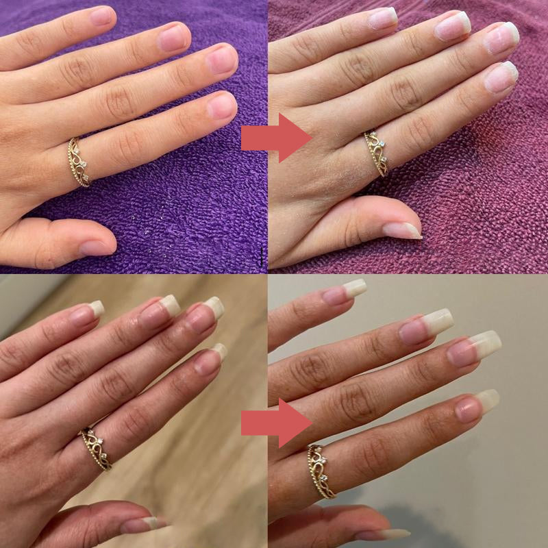 NailRevive™ - Stärkere, gesündere Nägel in wenigen Wochen