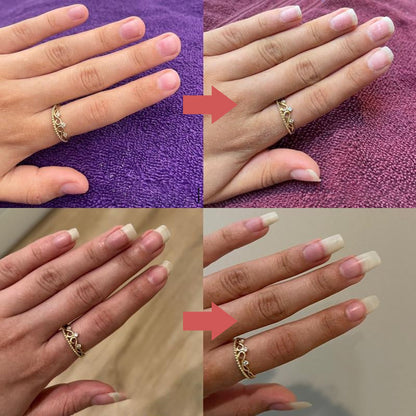 NailRevive™ - Stärkere, gesündere Nägel in wenigen Wochen