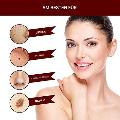 SkinClear™ - Natürliche Warzenentfernung ohne Schmerzen