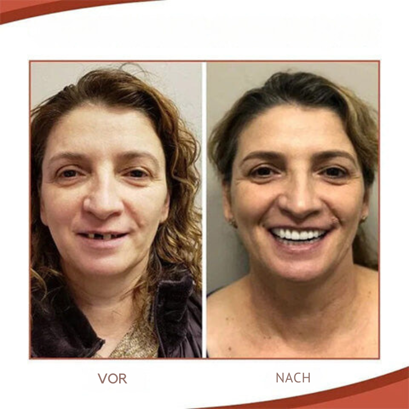 ComfortFit™ - Passt deine Prothese perfekt an - ohne Zahnarzt