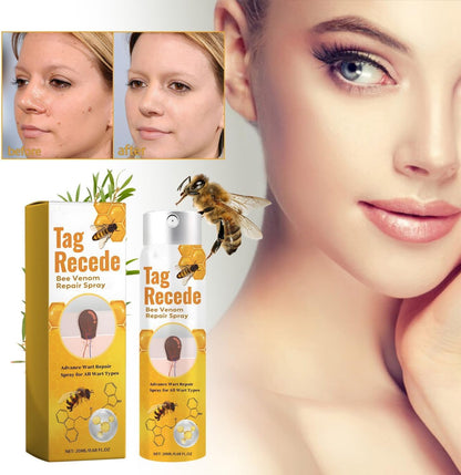 ClearSkin™ - Sanfte Warzen- & Hautanhängsel-Entfernung