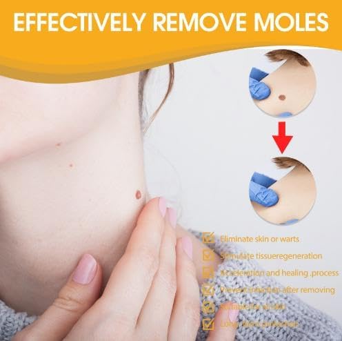 ClearSkin™ - Sanfte Warzen- & Hautanhängsel-Entfernung