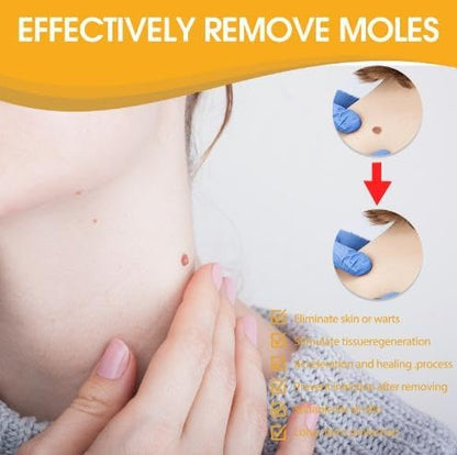 ClearSkin™ - Sanfte Warzen- & Hautanhängsel-Entfernung