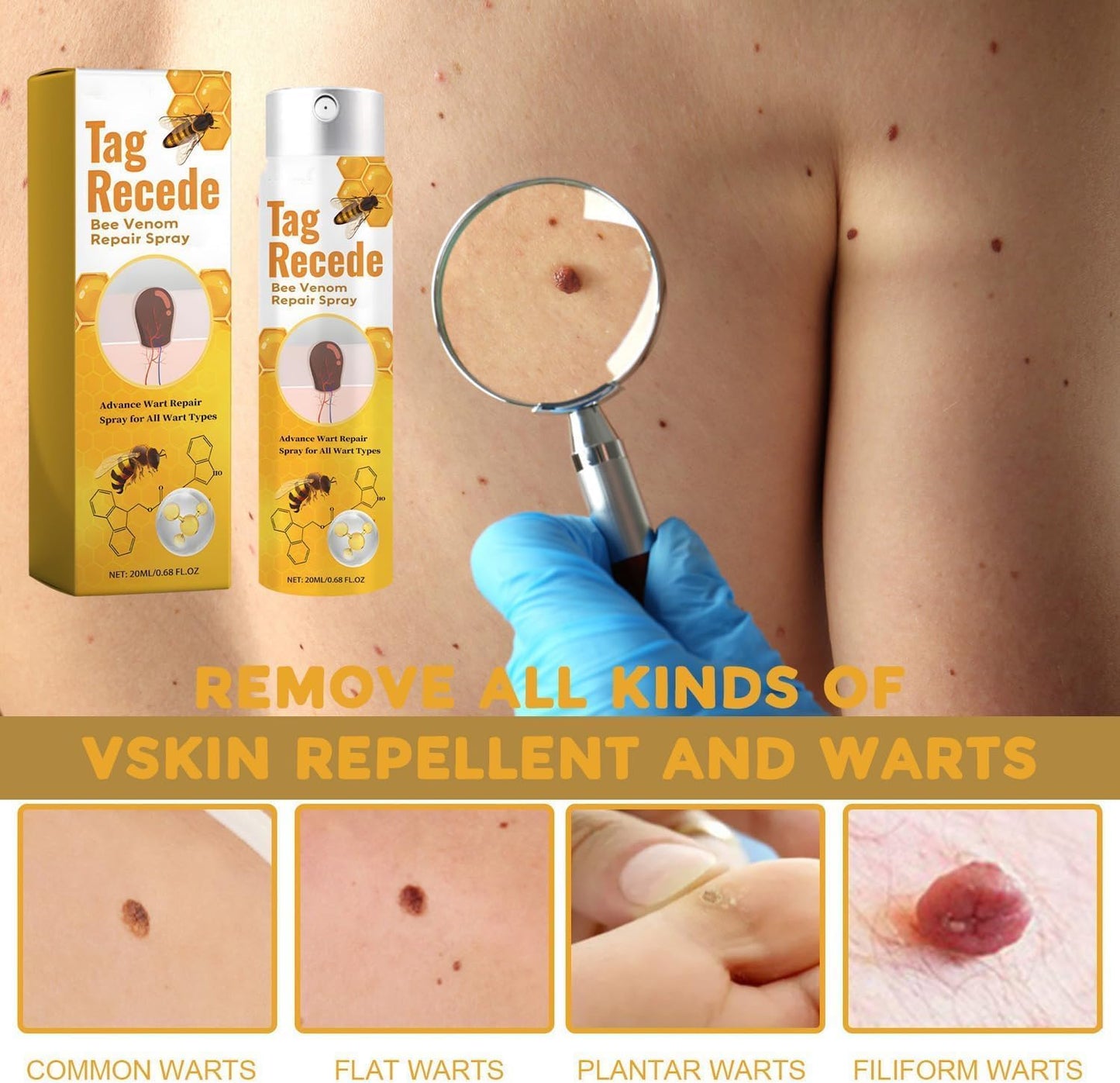 ClearSkin™ - Sanfte Warzen- & Hautanhängsel-Entfernung