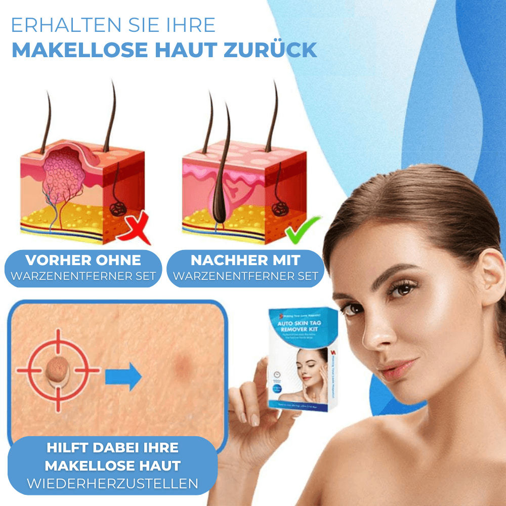BandAway™ - Schmerzfreies Hautanhängsel-Entfernungs-Set