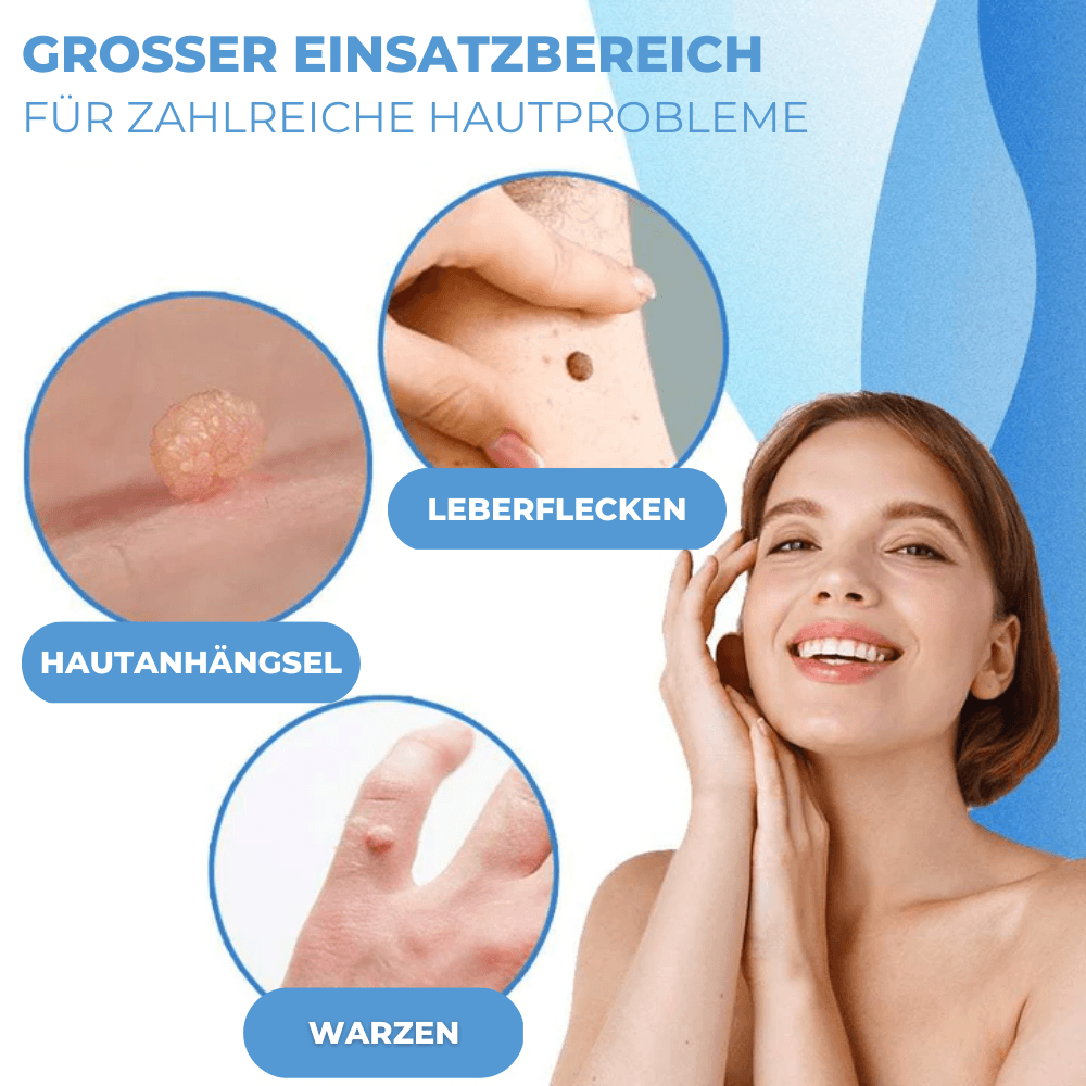 BandAway™ - Schmerzfreies Hautanhängsel-Entfernungs-Set