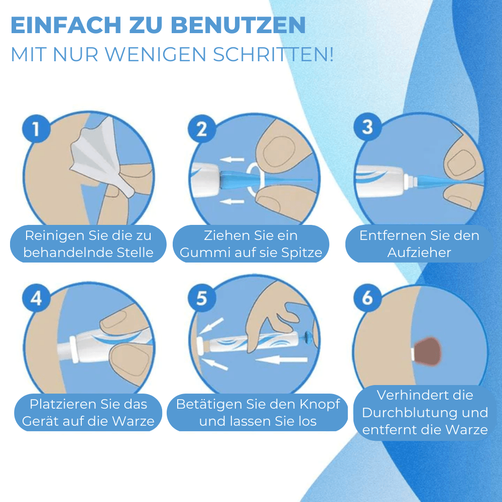 BandAway™ - Schmerzfreies Hautanhängsel-Entfernungs-Set