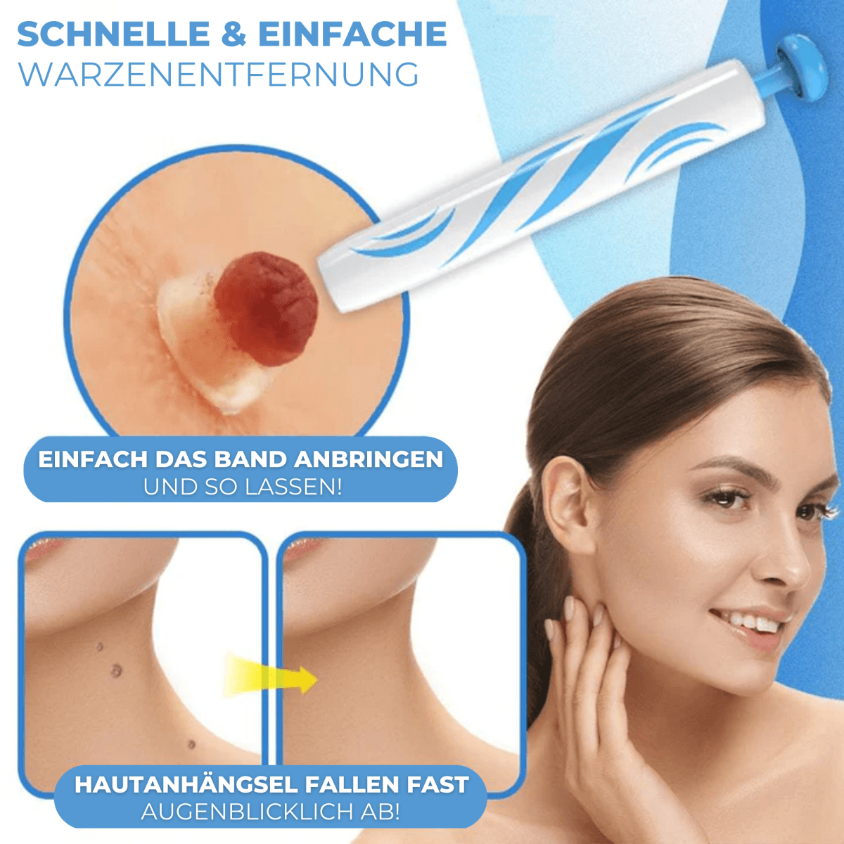 BandAway™ - Schmerzfreies Hautanhängsel-Entfernungs-Set